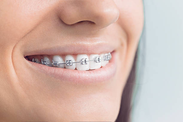 Dental Inlays and Onlays in Palm Beach, FL